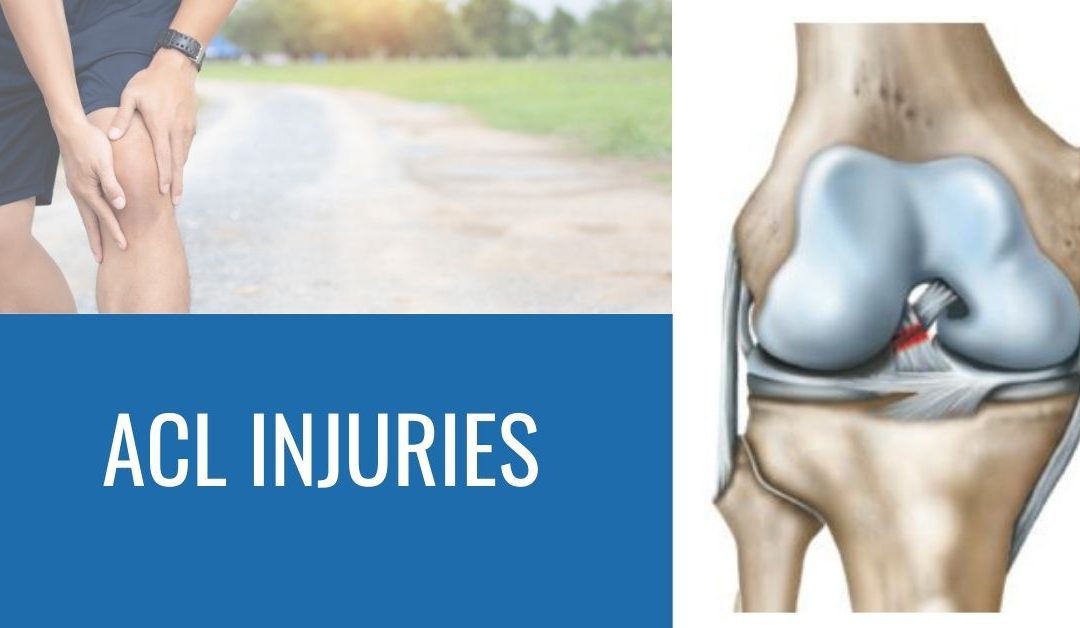 ACL Repair vs ACL Reconstruction