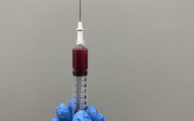 Top 3 Orthopedic Uses for PRP Injections