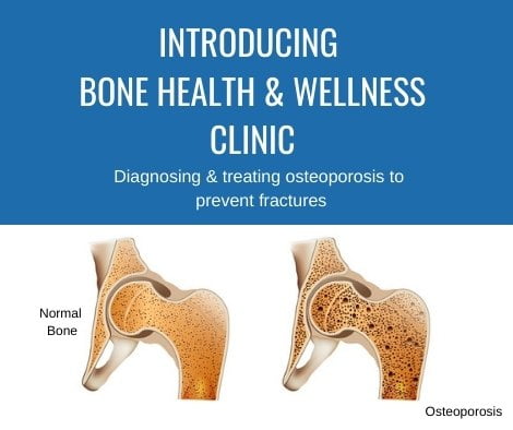 Bone health introduction sign for open house event